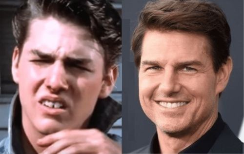 Tom